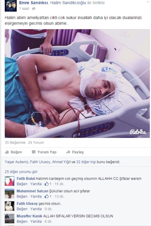 Başına Calaska Düşen Vatandaş Ameliyattan Çıktı