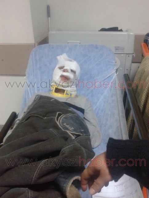 Bisikletten Düşen Çocuk Ölümden Döndü