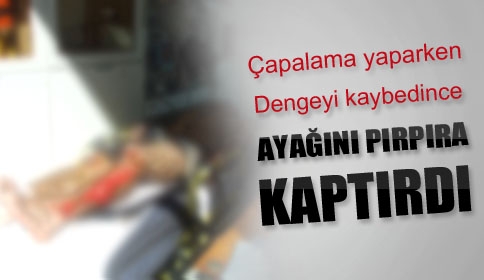 Bacaklarını Pırpıra Kaptırdı