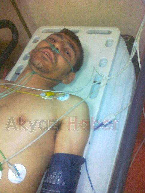 Bacaklarını Pırpıra Kaptırdı