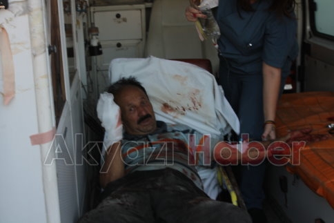 Eski Muhtar Odun Keserken Kolunu Kesti