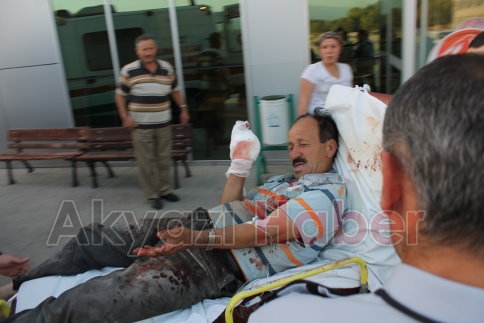 Eski Muhtar Odun Keserken Kolunu Kesti