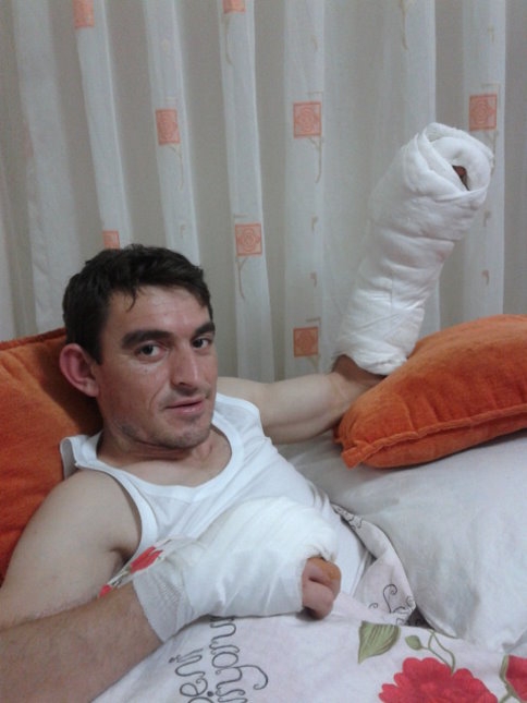 Çalıştığı Fabrikada Parmakları Kopan İşçi Fabrikadan Davacı Olacak mı ?