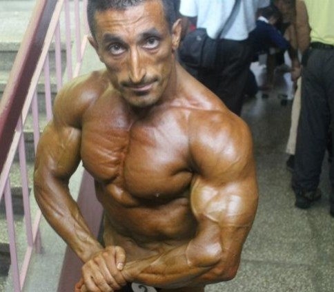 Akyazı Devlet Hastanesinde Dereceli Vücutçu