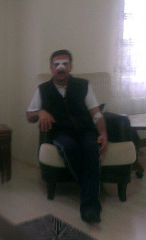 Ünal Gündüz Ameliyat Oldu