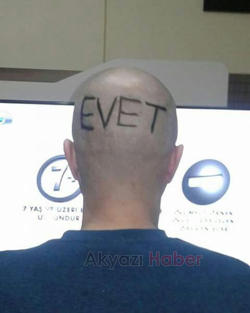  SAÇINA EVET YAZISI KAZITTI