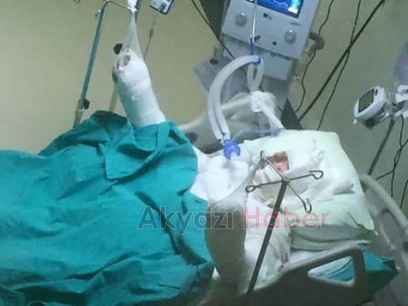 Sinan İçin ACİL Deri Nakli Gerekiyor