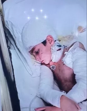 Sokak köpeklerinin ağır yaraladığı çocuğun ailesine 5 milyonluk tazminat