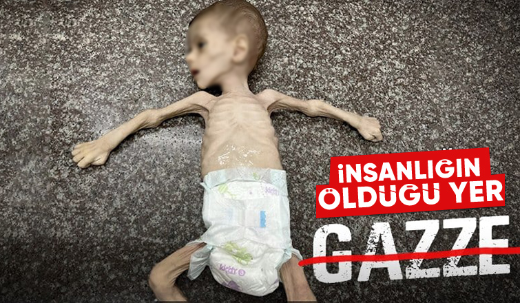 Gazze'de bir bebek daha açlık yüzünden can verdi.