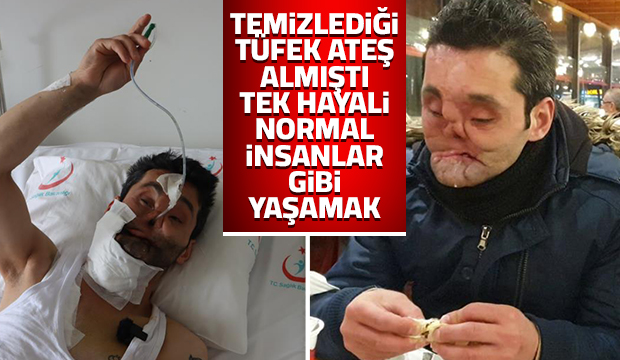 Gözlerini, çenesini ve burnunu kaybeden gencin hayali gerçek olacak