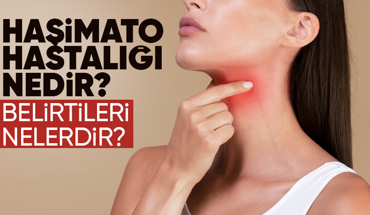 Haşimato hastalığı nedir? Belirtileri nelerdir?