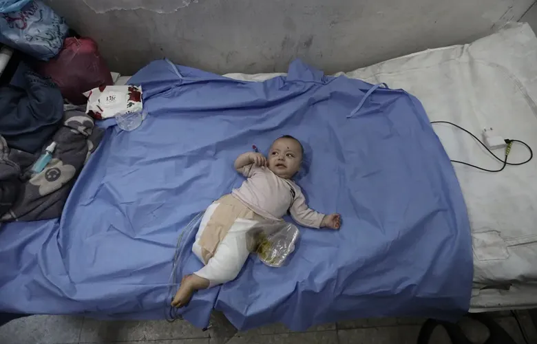 İsrail Bombardımanında 4 Aylık Bebek Bacağını Kaybetti