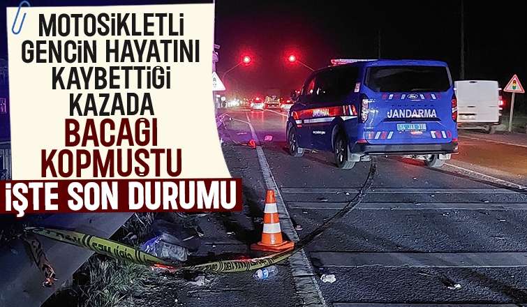 Kazada ayağı kopmuştu, son durumu açıklandı