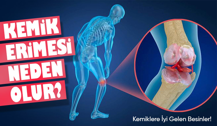 Kemik Erimesi Neden Olur? Kemiklere İyi Gelen Besinler! 