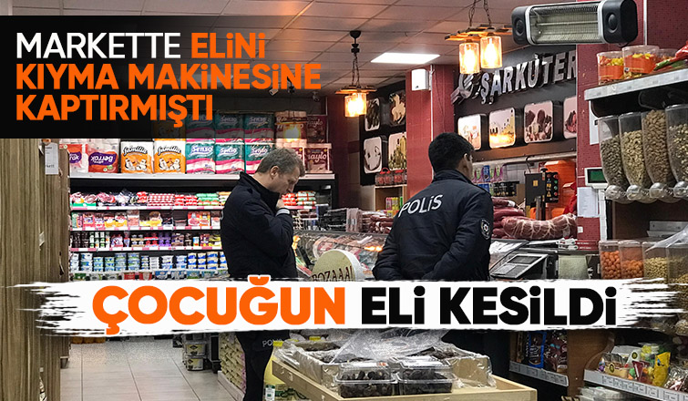Kıyma makinesine kaptırdığı eli kesildi