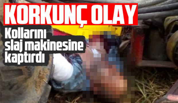 Kollarını slaj makinesine kaptırdı