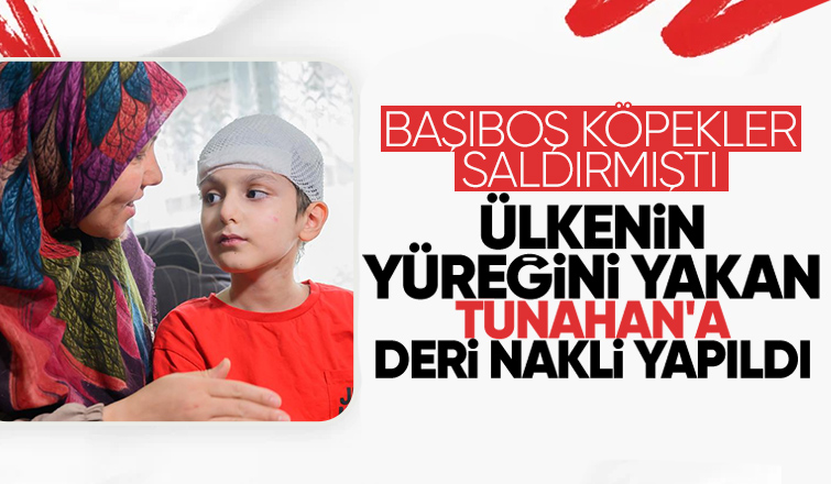 Köpekler saldırmıştı, Tunahan'a deri nakli yapıldı