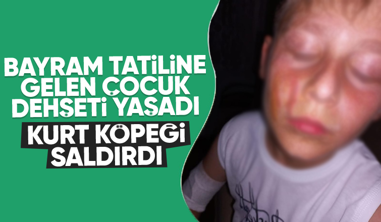 Kurt köpeğinin saldırdığı çocuk yaralandı