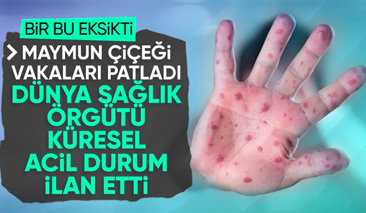 Maymun çiçeği virüsüne karşı dünya çapında acil durum ilan edildi