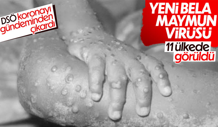 Maymun çiçeği virüsünün görüldüğü ülkeler