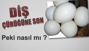 Diş Çürüğüne Son