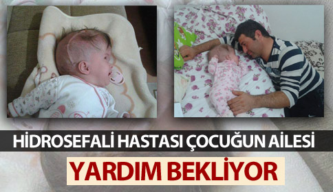 Hidrosefali hastası çocuğun ailesi yardım bekliyor