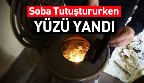 Soba Tutuştururken Yüzü Yandı.