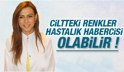 Ciltteki Renkler Hastalık Habercisi Olabilir
