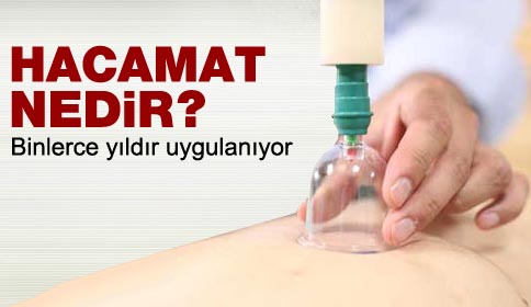 Hacamat nedir