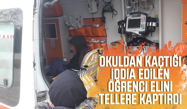 Öğrenci Elini Tellere taktırdı