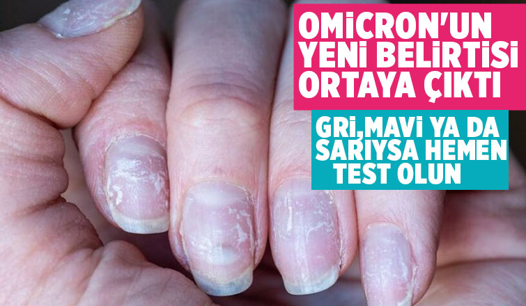 Omicron'un yeni belirtisi ortaya çıktı