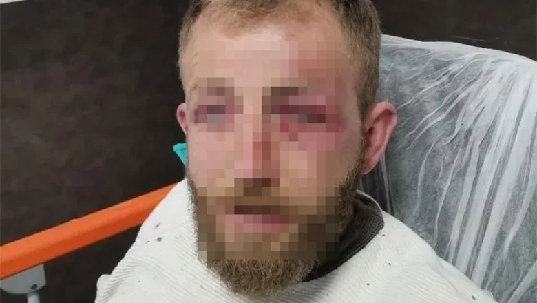 Ormanda dehşeti yaşadı