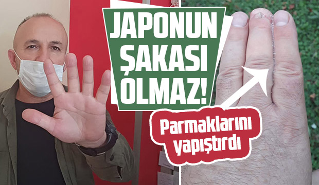 Parmaklarını yapıştırdı