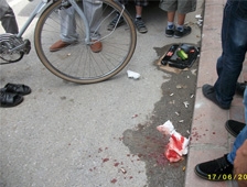 Motosiklet Bisiklete Çarptı | 2 YARALI 1'i AĞIR