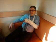 İrfan Kardeş Kolunu Kırdı