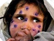 Bir Battaniye'de Sen Gönder