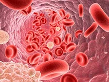 Kanserin 3 İşareti Kanama, Ağrı Ve Şişlik 