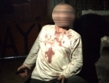 Sanayi Sitesinde Darp Edilen Şahıs Hastaneye Kaldırıldı