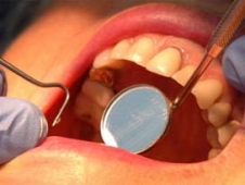 Artık Diş Tedavisine Ücret Ödemeyecekler