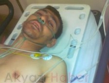 Bacak diz üstünden kesildi.