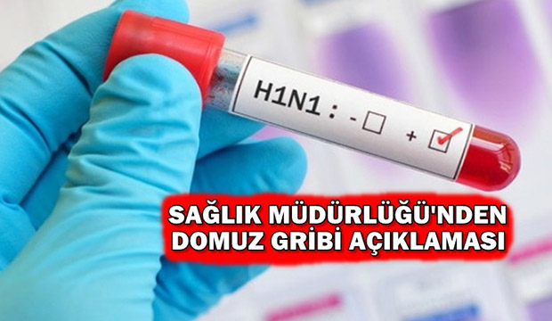 Sağlık Müdürlüğünden domuz gribi açıklaması