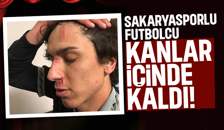 Sakaryasporlu futbolcu gol attı, kanlar içinde kaldı