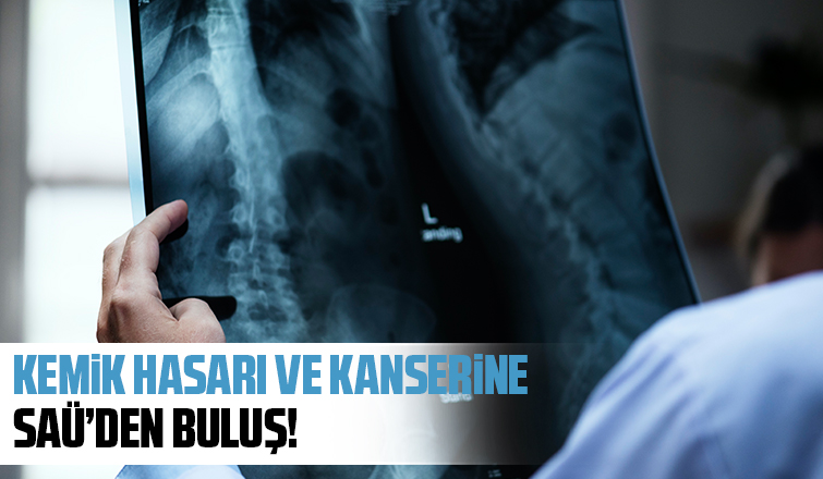 SAÜ'de kemik hasarlarında kullanılacak malzeme geliştirildi