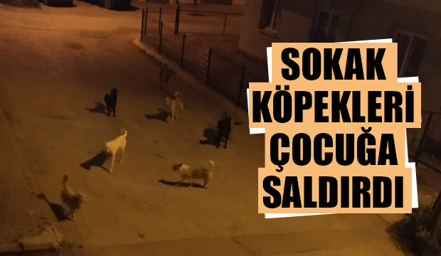 Sokak köpekleri çocuğa saldırdı