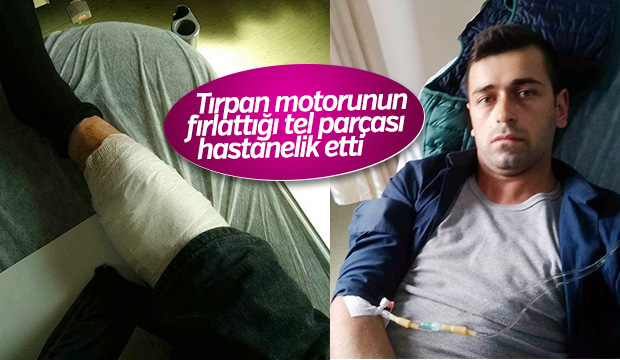 Tırpan Motorunun Fırlattığı Tel Parçası Hastanelik Etti