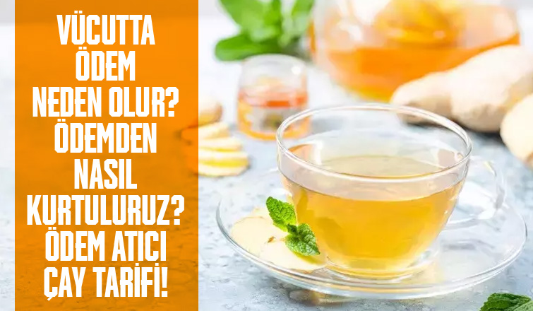 Vücutta Ödem Neden Olur? Ödemden Nasıl Kurtuluruz? Ödem Atıcı Çay Tarifi!