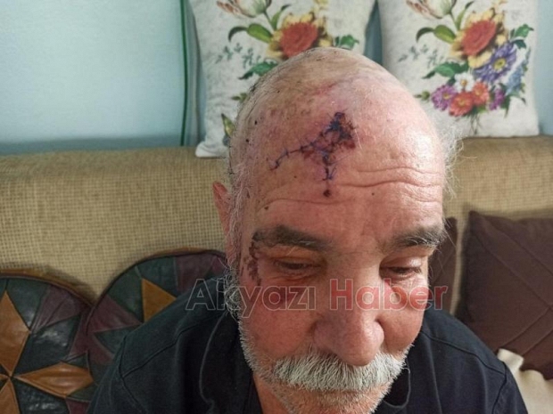 Pazar yerinde darp edilen yaşlı adamdan iyi haber