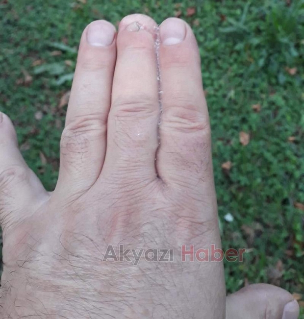 Parmaklarını yapıştırdı