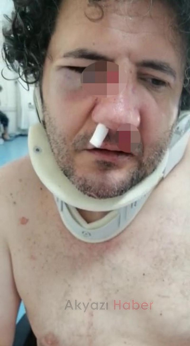 Nafaka yüzünden ölüm korkusuyla yaşıyor
