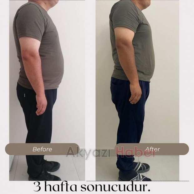 Sonuç garantili kişisel bakım sadece Esperança'da
